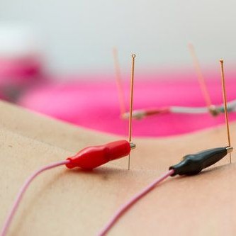 TCM - Electro-acupuncture (Square)